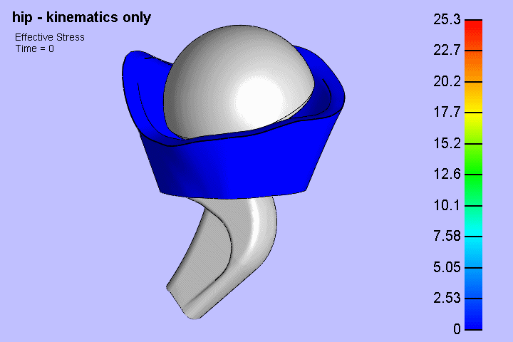 endoproteza stawu biodrowego endoproteza stawu biodrowego